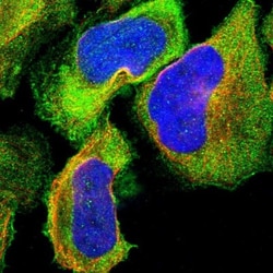 NMT1 Antibody, Novus Biologicals:Antibodies:Primary Antibodies